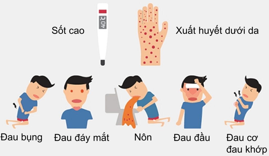 Các triệu chứng khi bị mắc sốt xuất huyết Dengue